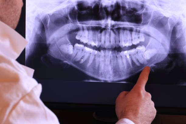 Best Dentist for Tooth Abscess  in Snyder, TX