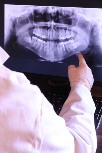 Best Emergency Tooth Extraction  in Snyder, TX